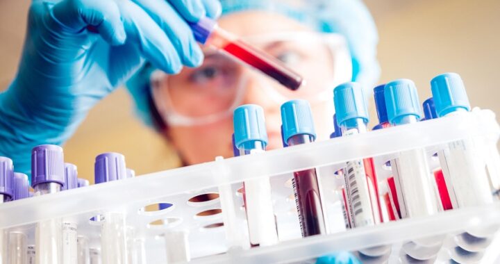 Understanding Laboratory Diagnostic Tests: Procedures and Importance