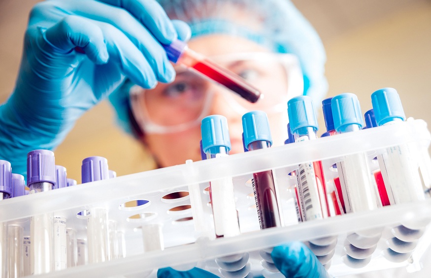 Understanding Laboratory Diagnostic Tests: Procedures and Importance