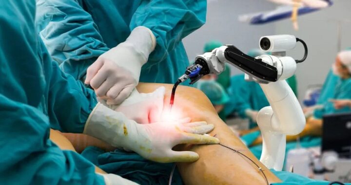 Robotic Knee Replacement Surgery